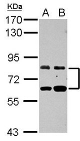 Sample (30 ug of whole cell lysate) A: HeLa B: HepG2 7.5% SDS PAGE ZFP64 antibody diluted at 1:1000