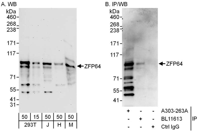 Detection of Human and Mouse ZFP64 by Western Blot (h and m) and Immunoprecipitation (h). Samples: Whole cell lysate from 293T (15 and 50 ug for WB; 1 mg for IP, 20% of IP loaded), Jurkat (J; 50 ug), HeLa (H; 50 ug) and mouse NIH3T3 (M; 50 ug) cells. Antibodies: Affinity purified rabbit anti-ZFP64 antibody used for WB at 0.04 ug/ml (A) and 1 ug/ml (B) and used for IP at 6 ug/mg lysate. ZFP64 was also immunoprecipitated by rabbit anti-ZFP64 antibody BL11613, which recognizes a downstream epitope. Detection: Chemiluminescence with exposure times of 3 minutes (A) and 30 seconds (B).