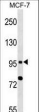 TLR6 Antibody (N11) western blot of MCF-7 cell line lysates (35 ug/lane). The TLR6 antibody detected the TLR6 protein (arrow).