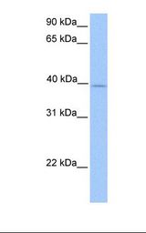 Hela cell lysate. Antibody concentration: 1.0 ug/ml. Gel concentration: 12%.