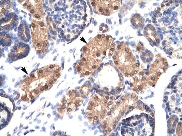 ZFPL1 antibody LS-C29783 was used in IHC to stain formalin-fixed, paraffin-embedded human kidney.