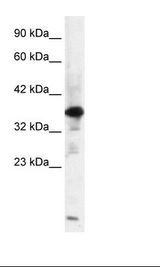 HepG2 Cell Lysate