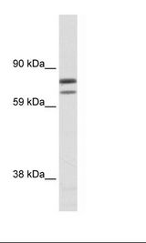 SP2/0 Cell Lysate