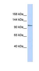 ZFPM1 / FOG1 antibody LS-C101379 Western blot of Fetal Muscle lysate.