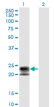 Western Blot analysis of TNFRSF17 expression in transfected 293T cell line by TNFRSF17 monoclonal antibody (M01), clone 1F10.Lane 1: TNFRSF17 transfected lysate(20.1 KDa).Lane 2: Non-transfected lysate.