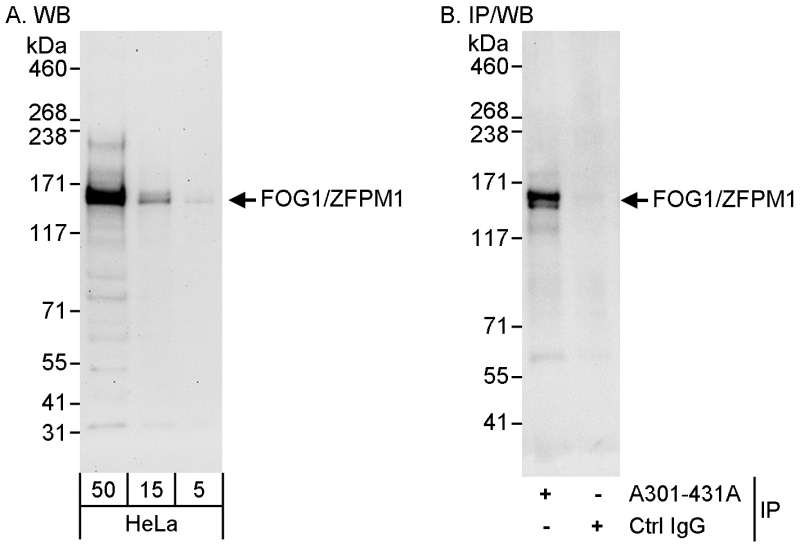 Detection of Human FOG1/ZFPM1 by Western Blot and Immunoprecipitation. Samples: Whole cell lysate (5, 15 and 50 ug for WB; 1 mg for IP, 20% of IP loaded) from HeLa cells. Antibodies: Affinity purified rabbit anti-FOG1/ZFPM1 antibody used for WB at 0.04 ug/ml (A) and 1 ug/ml (B) and used for IP at 3 ug/mg lysate. Detection: Chemiluminescence with exposure times of 3 minutes (A) and 10 seconds (B).