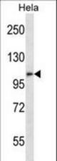 ZFPM2 Antibody western blot of HeLa cell line lysates (35 ug/lane). The ZFPM2 antibody detected the ZFPM2 protein (arrow).