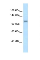 ZFR antibody LS-C145547 Western blot of Mouse Liver lysate. Antibody concentration 1 ug/ml.
