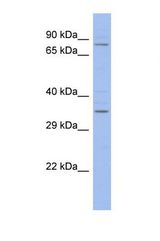 Western blot of Human ACHN. ZFX antibody dilution 1.0 ug/ml.