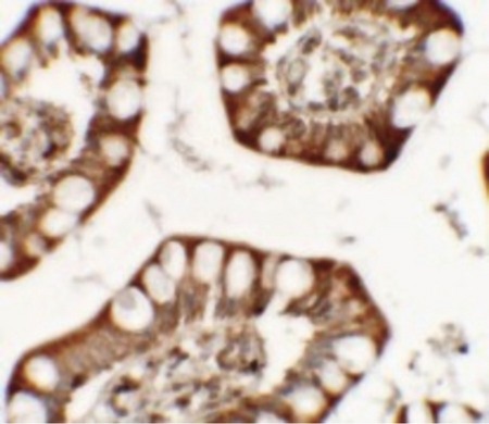 Immunohistochemistry of ZFX in human small intestine tissue with ZFX antibody at 5 ug/ml.