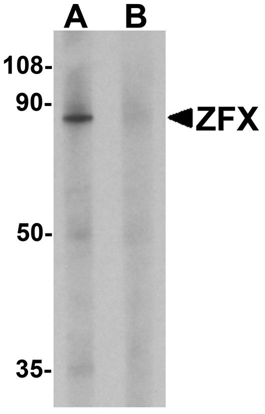 Western blot analysis of ZFX human small intestine tissue lysate with ZFX antibody at 1 ug/ml in (A) the absence and (B) the presence of blocking peptide.