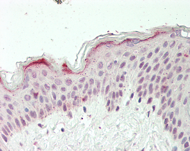 Human Skin: Formalin-Fixed, Paraffin-Embedded (FFPE)