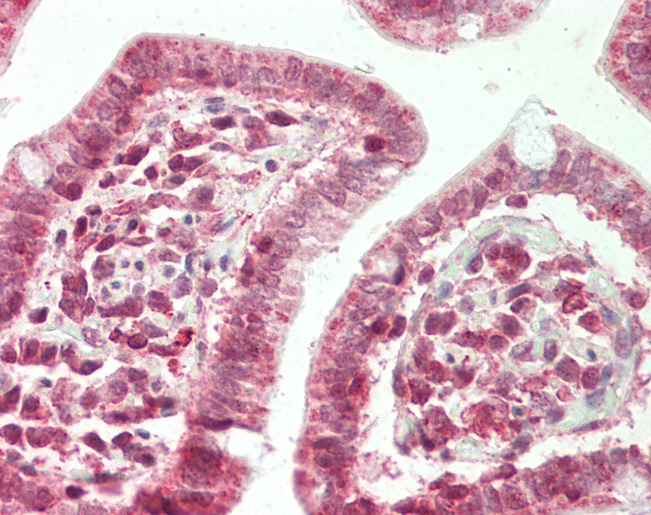 Human Small Intestine: Formalin-Fixed, Paraffin-Embedded (FFPE)