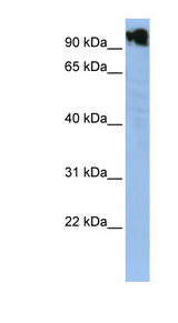 ZFY antibody LS-C101688 Western blot of HepG2 cell lysate.