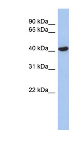 ZFYVE1 antibody LS-C111297 Western blot of Fetal Stomach lysate.