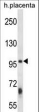 ZFYVE1 Antibody western blot of human placenta tissue lysates (35 ug/lane). The ZFYVE1 antibody detected the ZFYVE1 protein (arrow).