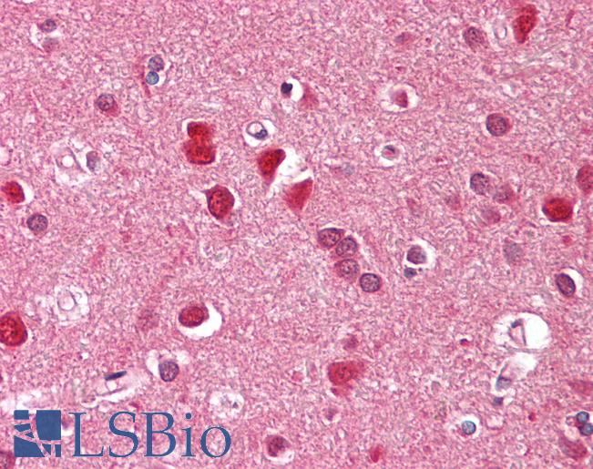 Anti-ZFYVE1 antibody IHC of human brain, cortex. Immunohistochemistry of formalin-fixed, paraffin-embedded tissue after heat-induced antigen retrieval. Antibody LS-B8202 dilution 2.5-5 ug/ml.