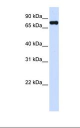 293T cell lysate. Antibody concentration: 1.0 ug/ml. Gel concentration: 12%.