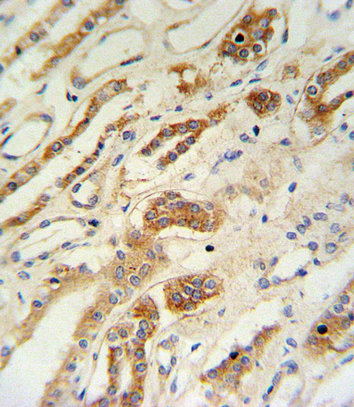 ZFYVE16 Antibody IHC of formalin-fixed and paraffin-embedded lung tissue followed by peroxidase-conjugated secondary antibody and DAB staining.