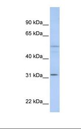 MCF7 cell lysate. Antibody concentration: 1.0 ug/ml. Gel concentration: 12%.