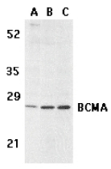 Western blot of BCMA in human spleen (A) tissue lysate, K562 (B), and U937 (C) cell lysates with BCMA antibody at 5 ug/ml.