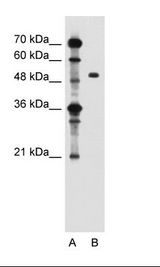 A: Marker, B: Jurkat Cell Lysate