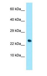 TNFRSF17 / BCMA antibody Western Blot of Human heart.