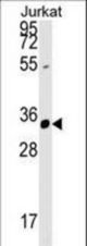ZFYVE27 Antibody western blot of Jurkat cell line lysates (35 ug/lane). The ZFYVE27 antibody detected the ZFYVE27 protein (arrow).