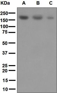 Western blot analysis on (A) Jurkat, (B) HeLa, and (C) fetal brain lysates using anti-SARA antibody.