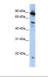 HepG2 cell lysate. Antibody concentration: 1.0 ug/ml. Gel concentration: 12%.