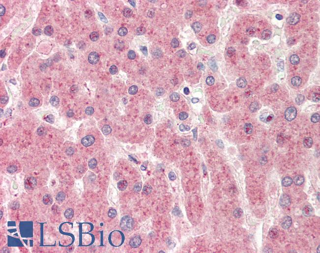 Human, Liver: Formalin-Fixed Paraffin-Embedded (FFPE)