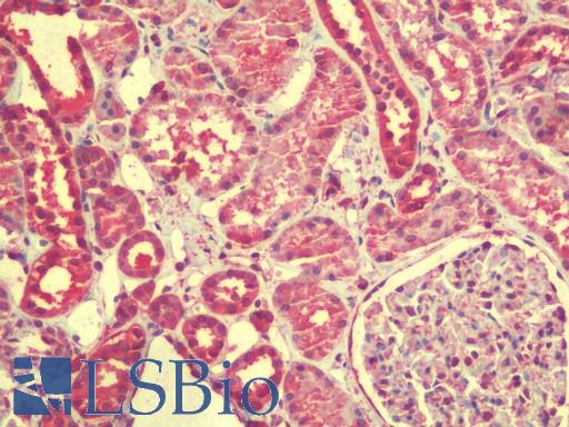 Anti-ZGPAT antibody IHC staining of human kidney. Immunohistochemistry of formalin-fixed, paraffin-embedded tissue after heat-induced antigen retrieval. Antibody LS-B9602 concentration 5 ug/ml.