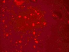 Immunofluorescence of ZGPAT in human brain cells with ZGPAT antibody at 20 µg/mL.