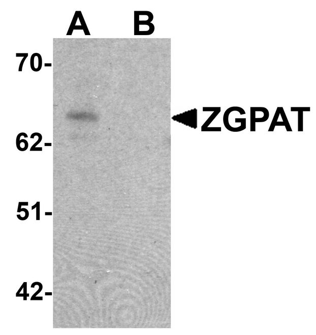 Western blot analysis of ZGPAT in SK-N-SH cell lysate with ZGPAT antibody at 1 ug/ml in (A) the absence and (B) the presence of blocking peptide.