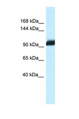 ZHX1 antibody LS-C145480 Western blot of Mouse Heart lysate. Antibody concentration 1 ug/ml.