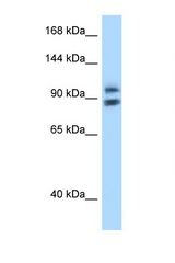 ZHX1 antibody LS-C146084 Western blot of PANC1 Cell lysate. Antibody concentration 1 ug/ml.
