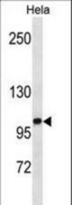 ZHX1 Antibody western blot of HeLa cell line lysates (35 ug/lane). The ZHX1 antibody detected the ZHX1 protein (arrow).