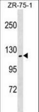 ZHX2 Antibody western blot of ZR-75-1 cell line lysates (35 ug/lane). The ZHX2 antibody detected the ZHX2 protein (arrow).