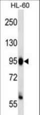 ZHX3 Antibody western blot of HL-60 cell line lysates (35 ug/lane). The ZHX3 antibody detected the ZHX3 protein (arrow).
