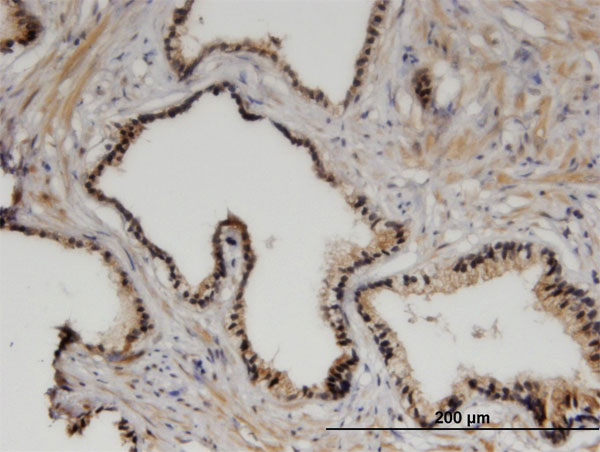 Immunoperoxidase of monoclonal antibody to ZHX3 on formalin-fixed paraffin-embedded human prostate. [antibody concentration 3 ug/ml]