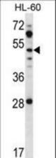 ZIC1 Antibody western blot of HL-60 cell line lysates (35 ug/lane). The ZIC1 antibody detected the ZIC1 protein (arrow).