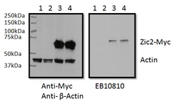 ZIC2 antibody RWPE1 lysate (60 ug protein in RIPA buffer) overexpressing Human ZIC2 with C-terminal MYC tag probed with (0.5 ug/ml) in the right panel and probed with anti-MYC Tag (1/1000) and anti-beta-Actin in the left panel. Mock-transfected RWPE1 in lanes 1 and expressing GFP in lanes 2. Primary incubations were overnight at 4C. Detected by chemiluminescence.