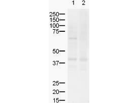 Anti-ZIC2 Antibody - Western Blot. Western blot of Affinity Purified anti-ZIC2 antibody shows detection of a band ~55 kD (arrowhead) corresponding to ZIC2 in lysates from (lane 1) mouse brain and (lane 2) rat brain. Approximately 20 ug of each lysate was run on a SDS-PAGE and transferred onto nitrocellulose followed by reaction with a 1:500 dilution of anti-ZIC2 antibody. Signal was detected using standard techniques. The upper band in the mouse brain lysate represents Zic2.
