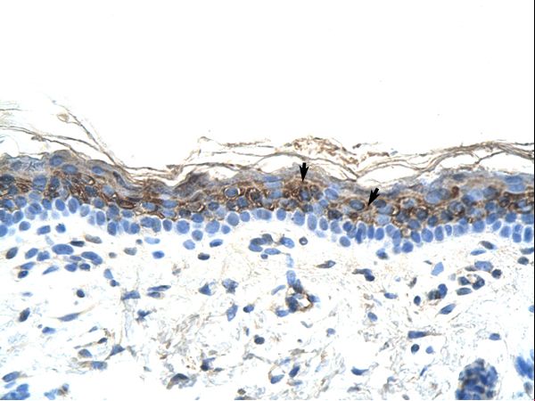 ZIC2 antibody LS-C30460 was used in IHC to stain formalin-fixed, paraffin-embedded human skin.