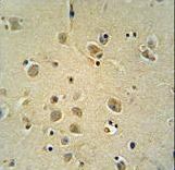 ZIC3 Antibody immunohistochemistry of formalin-fixed and paraffin-embedded human brain tissue followed by peroxidase-conjugated secondary antibody and DAB staining.