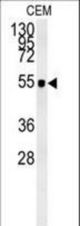 ZIC3 Antibody western blot of CEM cell line lysates (35 ug/lane). The ZIC3 antibody detected the ZIC3 protein (arrow).
