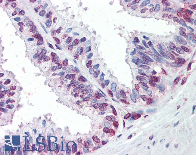Anti-ZIC3 antibody IHC staining of human prostate. Immunohistochemistry of formalin-fixed, paraffin-embedded tissue after heat-induced antigen retrieval. Antibody LS-B9538 concentration 5 ug/ml.