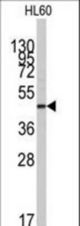 Western blot of anti-ZIC3 Antibody in HL60 cell line lysates (35 ug/lane). ZIC3(arrow) was detected using the purified antibody.