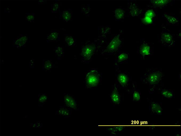 Immunofluorescence of monoclonal antibody to ZIC4 on HeLa cell (antibody concentration 7 ug/ml).