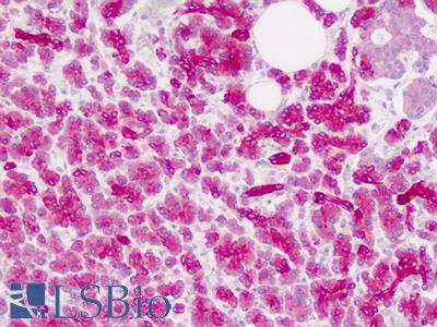 Human Pancreas: Formalin-Fixed, Paraffin-Embedded (FFPE)